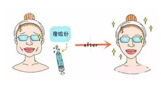 上海整形医院做注射瘦脸多少钱？