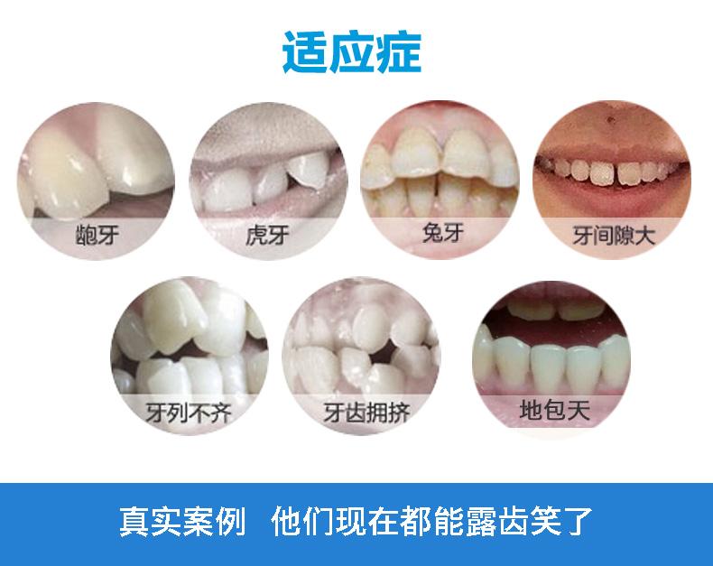 上海做牙齿隐形矫正多少钱