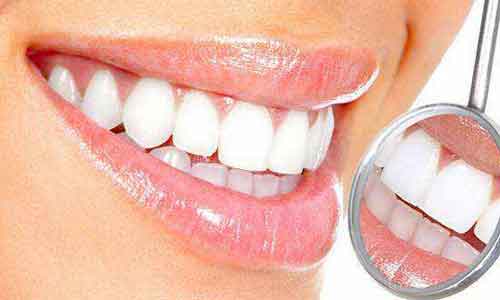 美莱美容冠、牙贴面、冷光美白都有哪些牙齿美白优势?