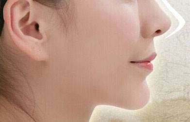 肋软骨隆鼻价格费用上海一般是多少？