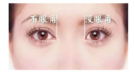 上海眼部整形做了开眼角之后会留疤吗
