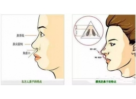 自体耳软骨隆鼻医院，上海美莱自体耳软骨隆鼻怎么样