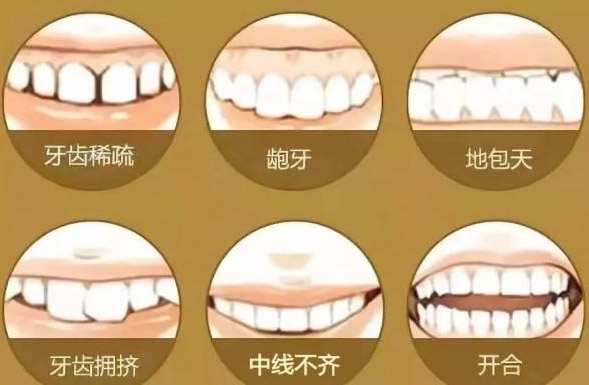 上海口腔做牙齿矫正一般价格在多少钱