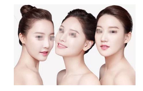 上海美莱皮肤美容告诉您春季护肤要注意“三防”！