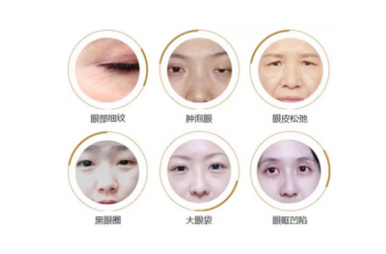 上海美莱对抗眼部衰老，这7大因素请注意！