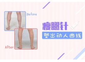 上海注射瘦腿价格，瘦腿多少钱一支