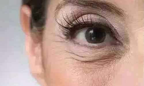 眼部肌肤老化怎么办?美莱注射玻尿酸解决眼部肌肤老龄化问题!