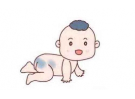 新生儿 青色胎记怎么治疗好?上海激光可以治疗!