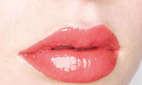 美莱玻尿酸丰唇恢复多久可以KISS?