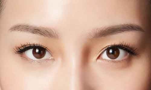 上海平行型、扇形、新月型、欧式双眼皮它们的区别是什么?