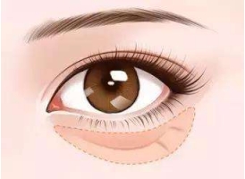 眼综合跟鼻综合能做好几个吗？上海眼综合怎么样？