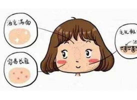 上海光子嫩肤能改善毛孔粗大吗?