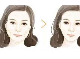 上海打注射瘦脸怎么避免脸部凹陷?