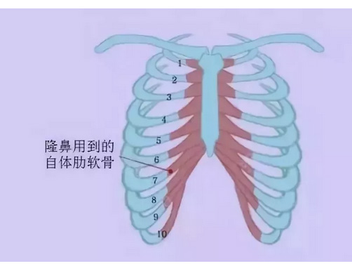 隆鼻福利|上海美莱告诉你隆鼻方式有这么多种！