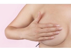 自体脂肪隆胸比假体隆胸要安全吗？