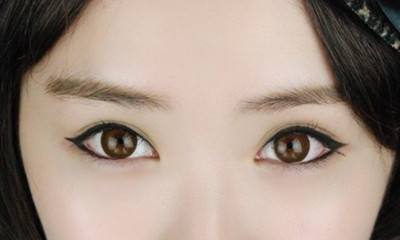 上海美莱:什么样的眼睛适合开眼角?