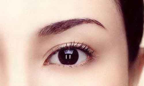 上海双眼皮埋线手术意外会发生吗?