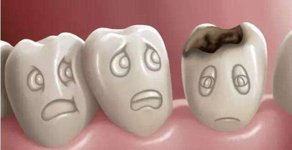 美莱做牙齿修复四种方式，牙齿缺了别着急！