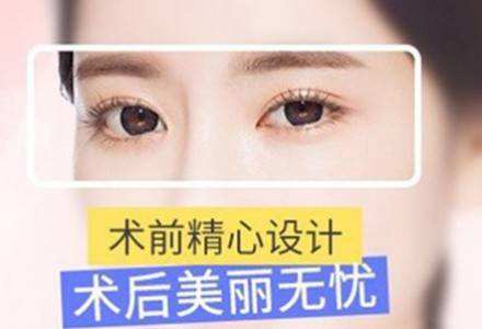 上海美莱韩式三点双眼皮，让眼睛自然起来