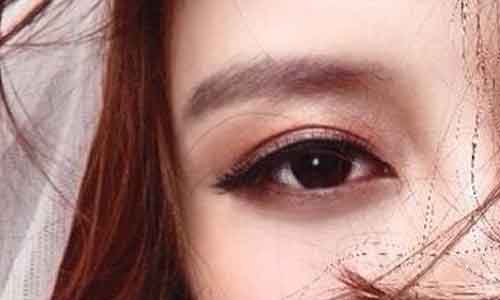 上海不易留疤痕双眼皮的原理是什么?