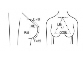 上海做隆胸术，假体隆胸和脂肪隆胸哪个好？