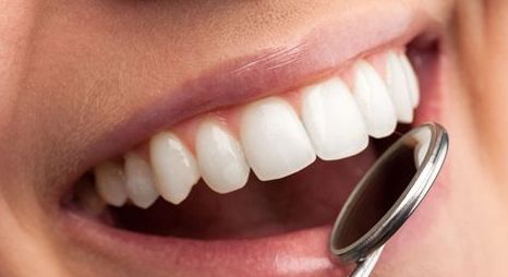 哪些类型的牙齿适合做冷光美白
