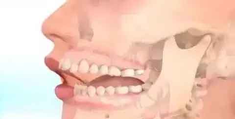 上海牙齿松动可以矫正吗?