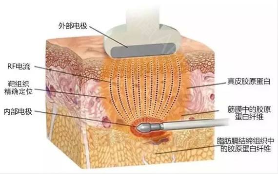 上海除皱医院哪家好，美莱怎么样