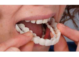 成年人牙齿矫正佩戴时间是多久?