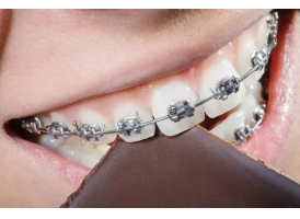 上海牙齿整形的方法有哪些?