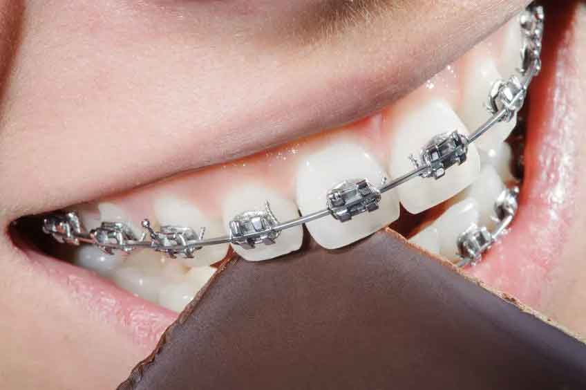 上海牙齿整形的方法有哪些?