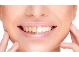 牙黄是什么原因导致的?美莱