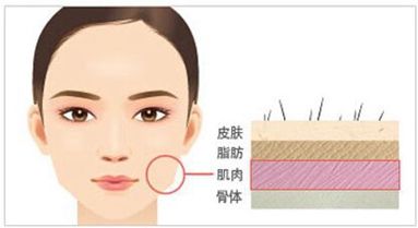 脸部注射瘦脸上海哪家医院打得好