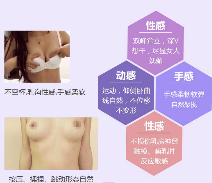 上海假体隆胸整形医院美莱优势