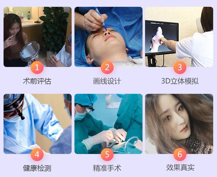 上海哪家整形医院做鼻子比较好