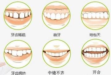 上海矫正牙齿的费用大概是多少