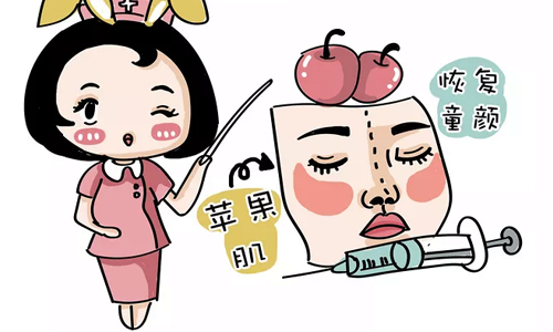 上海苹果肌凹陷修复需要多少钱
