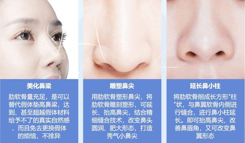 自体肋骨隆鼻在上海做要多少钱
