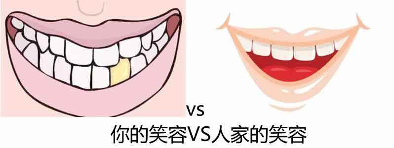 上海牙齿美白美莱有什么优势