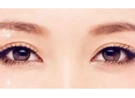 上海双眼皮手术可以改善哪些眼部问题呢