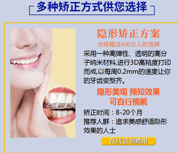 上海矫正牙齿