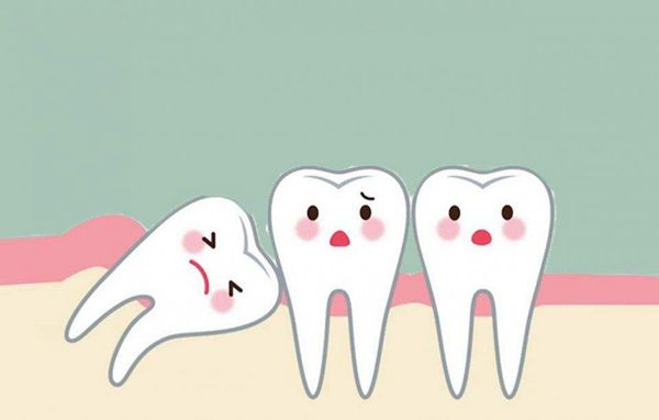 上海矫正牙齿美莱讲述|我国90%成年人患牙周炎
