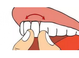 牙齿松动是什么原因