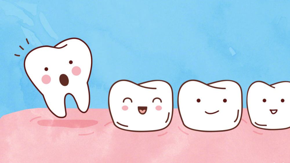 美白牙齿超声波洁牙需要注意什么护理事项