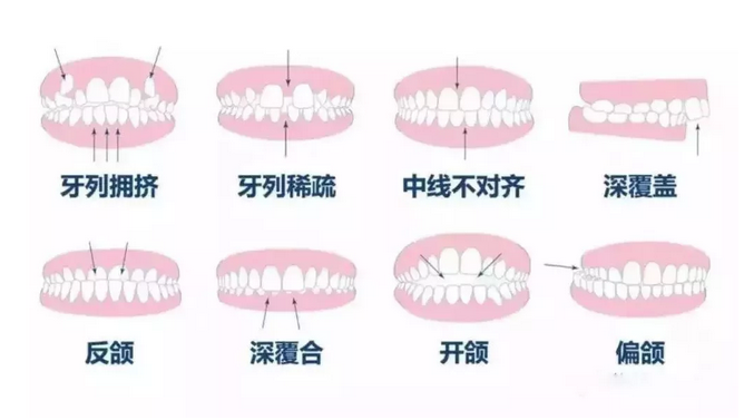 上海美莱周年庆牙齿矫正价格多少钱