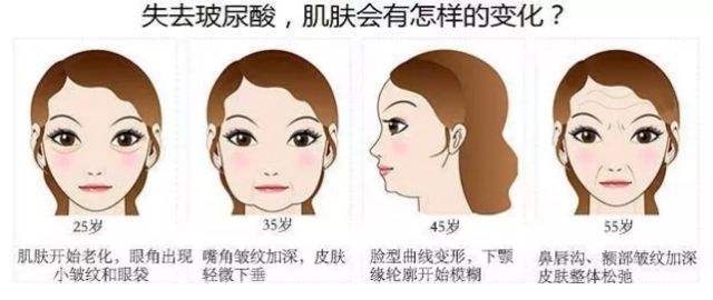 上海美莱注射美容玻尿酸的作用有哪些