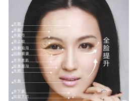 面部年轻化埋线提升做一次就可以永远长久保持吗
