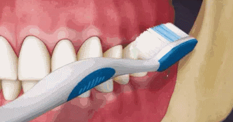 上海美莱口腔，刷牙的错误动作90%人每天都在做