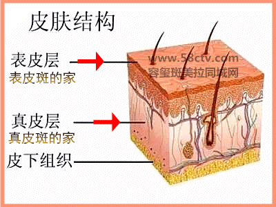 上海美莱表皮斑和真皮斑的区别