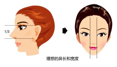 上海鼻部整形价格做假体多少钱